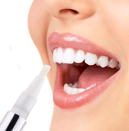 Teeth Whitening Pen | 1+1 FREE - Femme Trendz